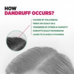 SLS and Paraben Free Sebamed Anti Dandruff Shampoo