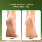 Vega 3 in 1 Pedicure Foot Care Tool PD-20