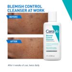 Anti-blemish face cleanser for smoother and clearer skin