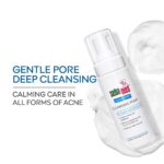 Sebamed foam face wash designed for oily skin care